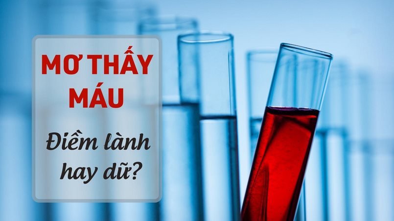 Giấc mơ siêu đặc biệt mang tên mơ thấy máu